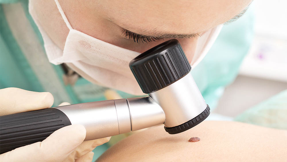 Médica observa pinta de paciente.