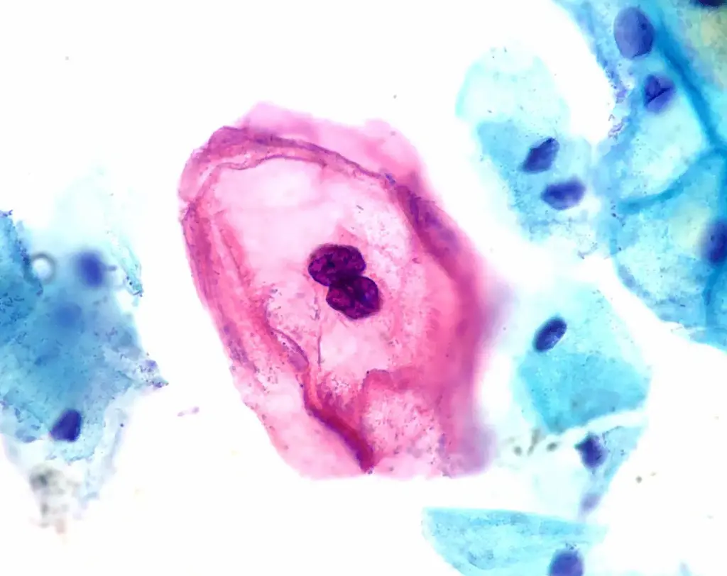 HPV
